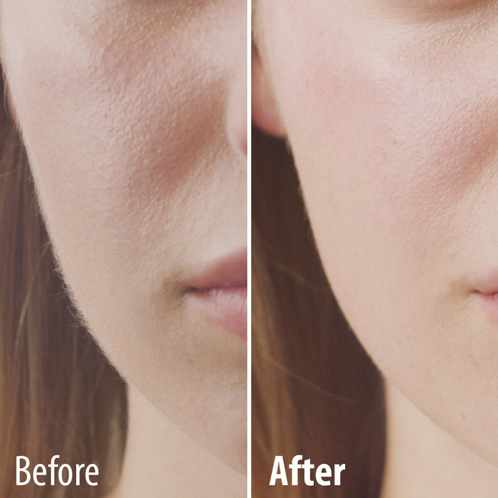 Perfect Face Facial Hair Remover - Buy 1 Get 1 Free