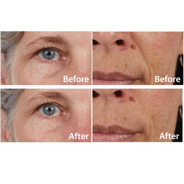 5in1 Facial Solution - Buy One Get One Free!
