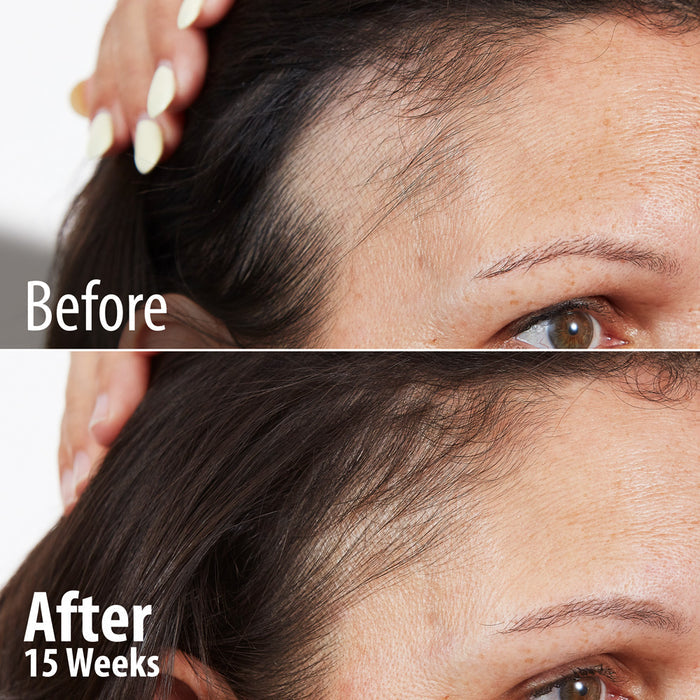 Age Reverse Collagen Peptides Powder : Bundle Offer