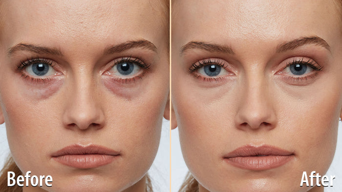 Age Reverse Concealer - Buy One, Get One Free!