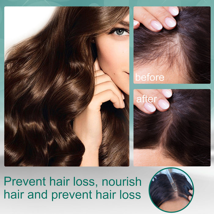 EELHOE Ginger Up Regrow & Repair Hair Nutrition Hair Care Essential Oil EELHOE COSMETICS