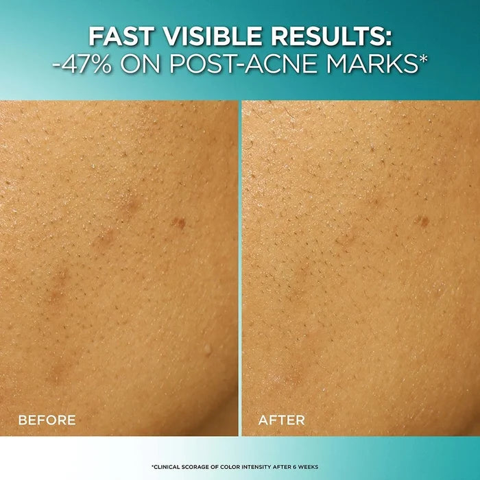 LOREAL PARIS Bright Reveal Dark Spot Exfoliant Peel مقشر لوريال باريس لتقشير البشرة وتفتيح البقع الداكنة
