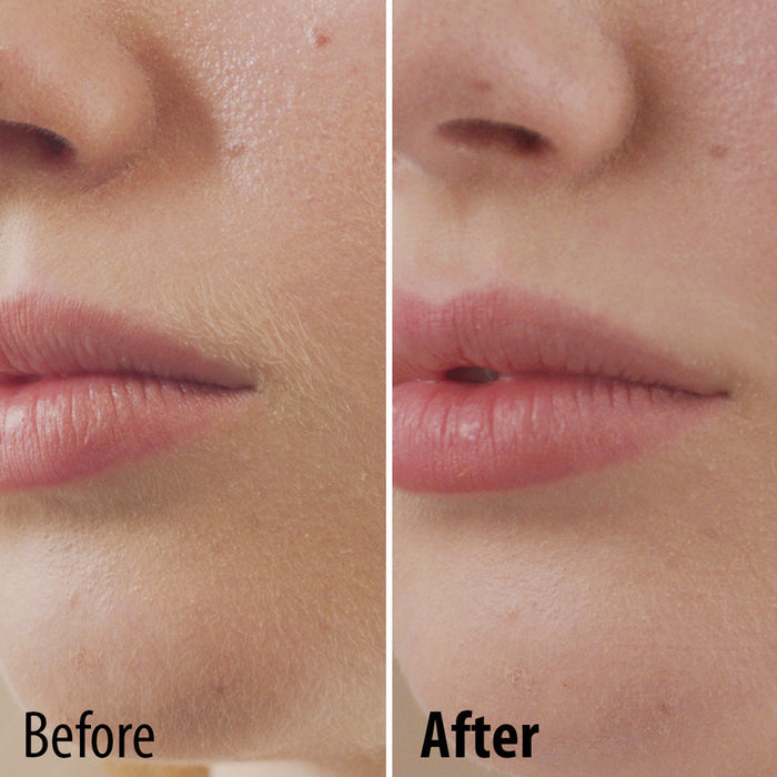 Perfect Face Facial Hair Remover - Buy 1 Get 1 Free