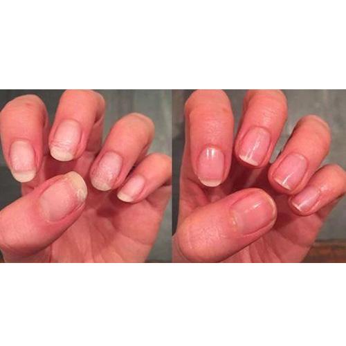 Pink Armour Nail Gel - Buy 1 Get 1 Free