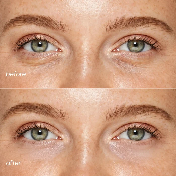 Pink Eye Patches for Puffy Eyes