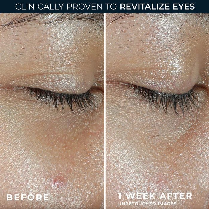 ROC Revive + Glow Vitamin C Eye Balm