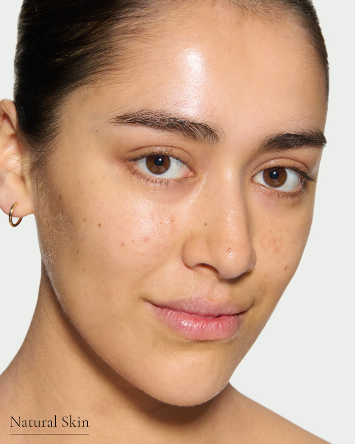 before1 block Close-up of a model's face with no makeup on a plain background with text 'Natural Skin'